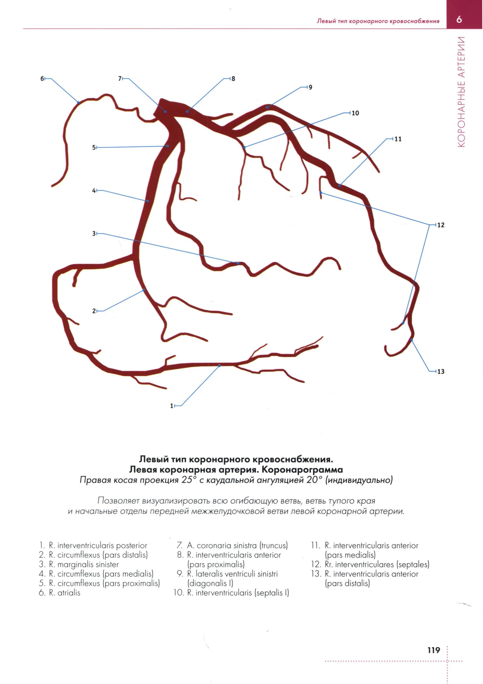 Левый тип коронарного кровоснабжения. Левая коронарная артерия. Коронарограмма